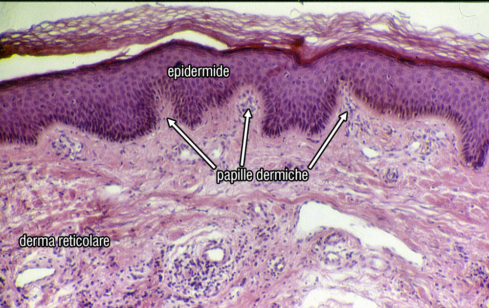Sezione di epidermide con derma